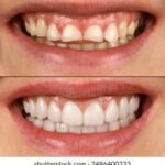 18158期双色球开奖号码正式公布 f1lxz6h